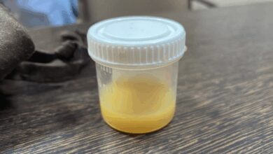 cloudy urine
